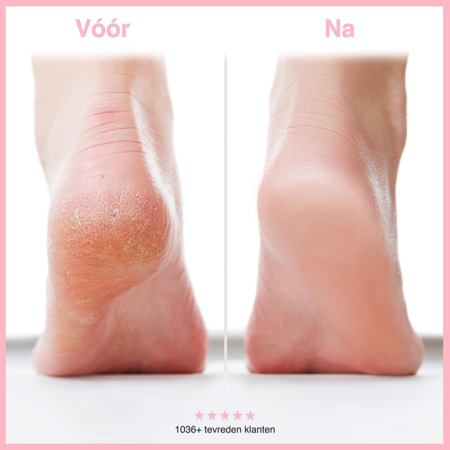 Heel Glow – Zachte voeten in 2 min