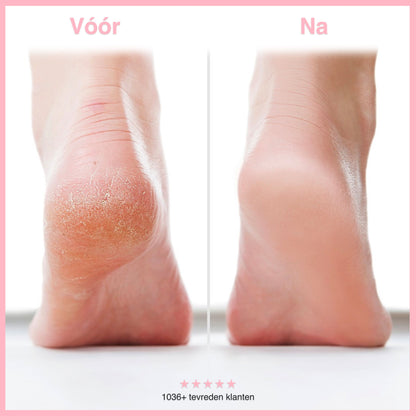 Heel Glow – Zachte voeten in 2 min